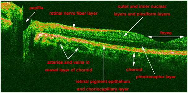 Fig 2.JPG